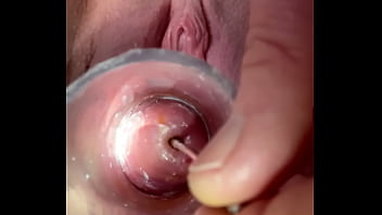 Sound Going Deep Into Cervix