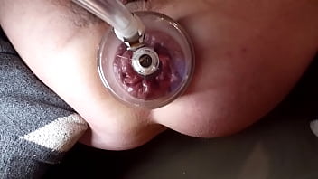 Please Suck My Prolapse