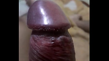 Papulas Perladas / Pene Enperlado Natural