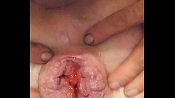 Me Pushing Out My Toy And Vibrator Stretching My A******* And Prolapsing