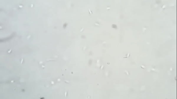 Soi tinh trùng chú bộ đội