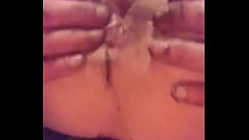 Gay, Prolapse, Rosebud - Gay - 2025 - Incredible - Session - Video 2277620