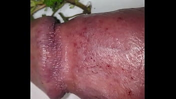 First Nettles 2021 For My Bruised Cock