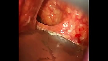 Gyno-fetish, Rectal-exam - Unknown - 2025 - Intense - Performance - Video 2210202