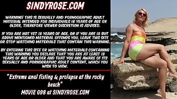 Extreme Anal Fisting _ Prolapse At The Rocky Beach Sindy Rose