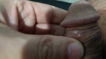 De Tanto Minha Mulher Beliscar Meu Pintinho Acabei Ficando Com Bolhas Nele