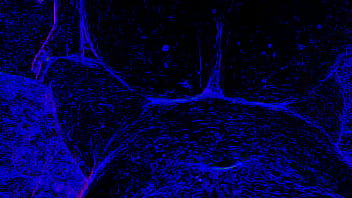 Smarien75 And Shellyseth In The Blacklight