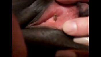 Maggot Entering Black Woman' Urethra!