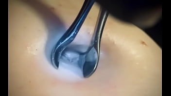 Belly Button Deep Exploration