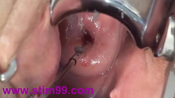 Cervix Fucking Play Deep Japanese Asian - _____é__é__ã__ã__