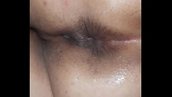 Casero, Ano, Hemorroide - Unknown - 2025 - Hot - Session - Video 1950368