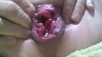 Anus, Audio, Prolapse, Rosebud, Ecarter - Unknown - 2025 - Intense - Experience - Video 1986296