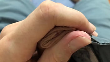 Fui Diagnosticado Com Fimose E Não Tenho Vergonha De Mostrar