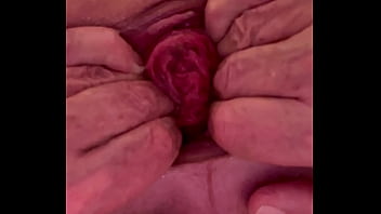 Hole Stretching With Rosebud 3