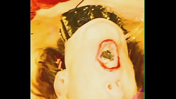 Scarlet Urine Stain
