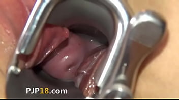 Camera Deeply In Her Gaped Vagina Vagina - hole, full, camera, download, resolution - Video 6236228