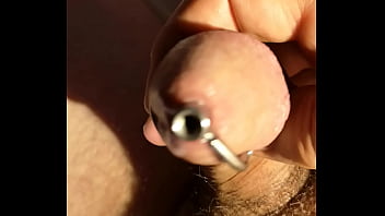 Urethral Catheter Inserted