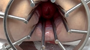 Gs2, Bdsm Mistress, Massive Anal Speculum, Wide Open Ass, Strapon, Extreme Anal Gap