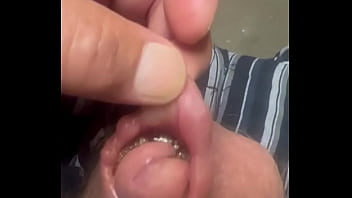 Maggots Invade My Penis And Eat Into My Urethra.