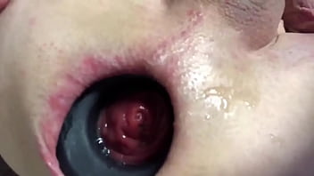Anal Gaping Anal Prolapsing Anal Vacuum Pumping Compilation