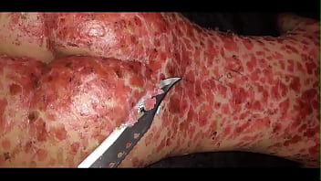 Fetiche O Tesão De Brincar Com Velas