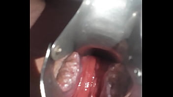 Culo Juguetón, Pot Salva