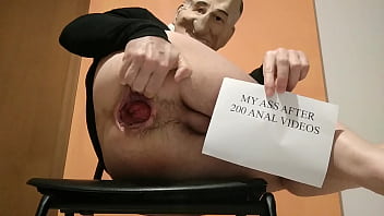My Ass After 200 Extreme Anal Videos