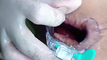 Abrindo O Cuzinho Com Especulo