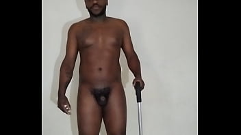 Blogging I Have No Foreskin(an Amputee)