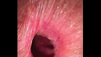 She Farted So Hard That I Lost Consciousness And Sex Stopped