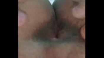 Anna Julia Se Depilou, Vem Ver O Resultado, Com Um Extra Mostrando O Antes E Depois