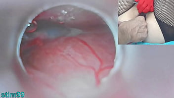 Japanese Insemination With Cum Into Uterus And Endoscope Camera By Cervix To Watch Inside Womb Uncensored