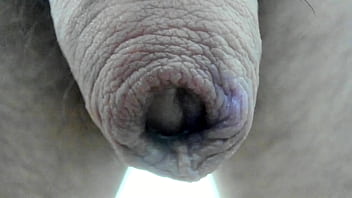 My Foreskin Superclose :)