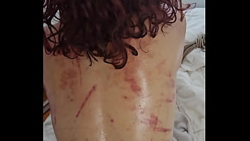 Hard Fucking My Bruised Booty ~ Aftermath Of A Bdsm Festival